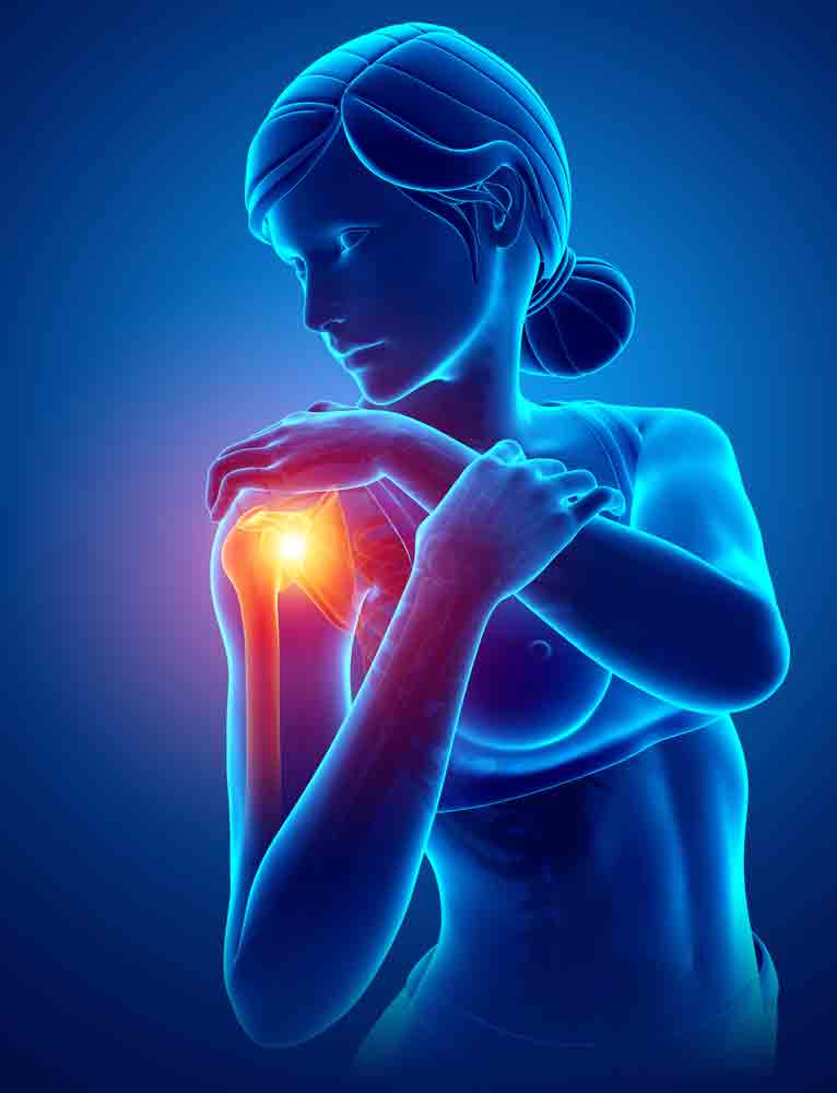 understanding shoulder impingement syndrome pain management